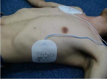 電極パッドを取り付けられた上半身を横方向から捉えた写真